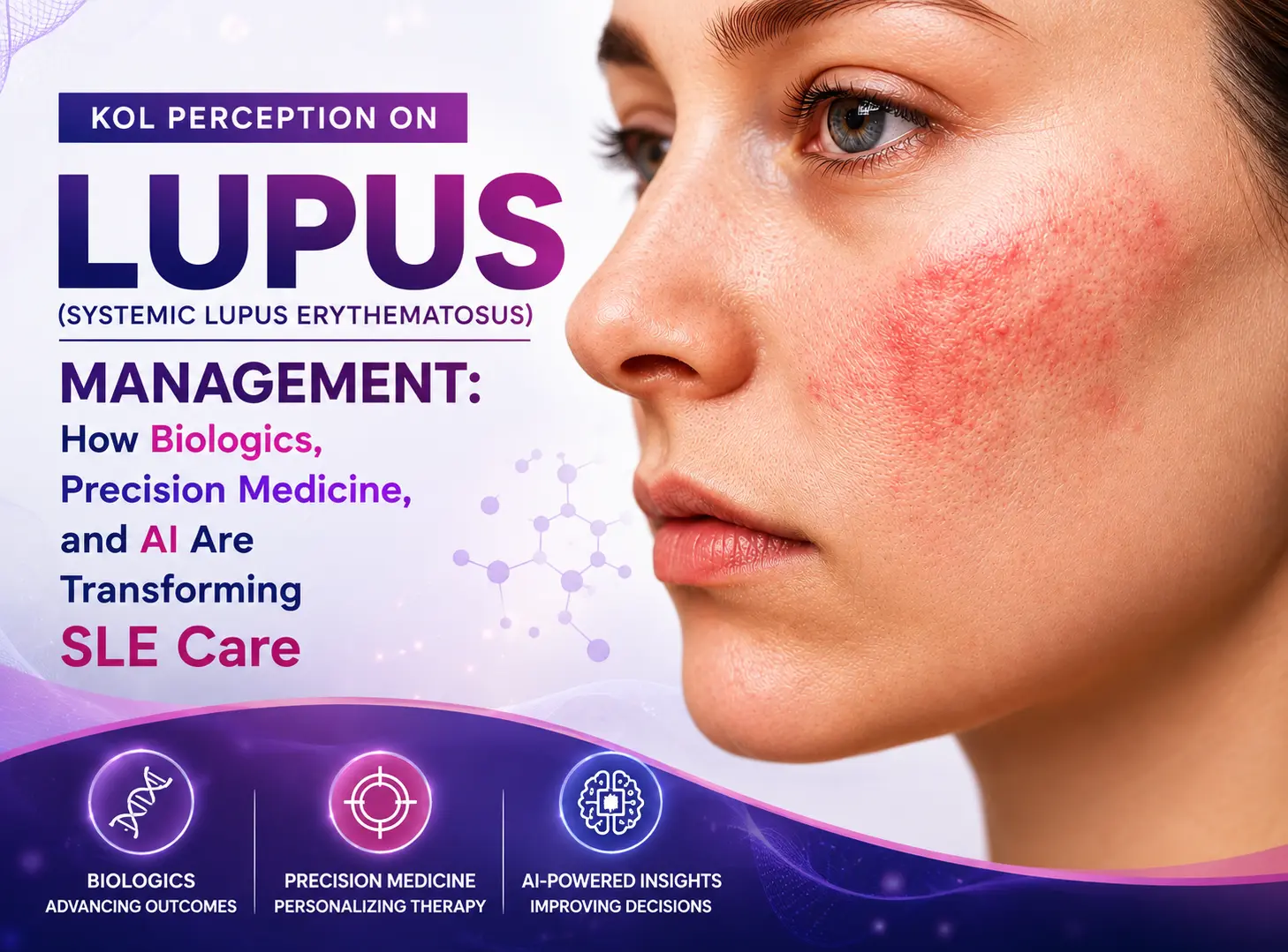 Lupus Management : KOL Insights on Biologics, Precision Medicine & AI
